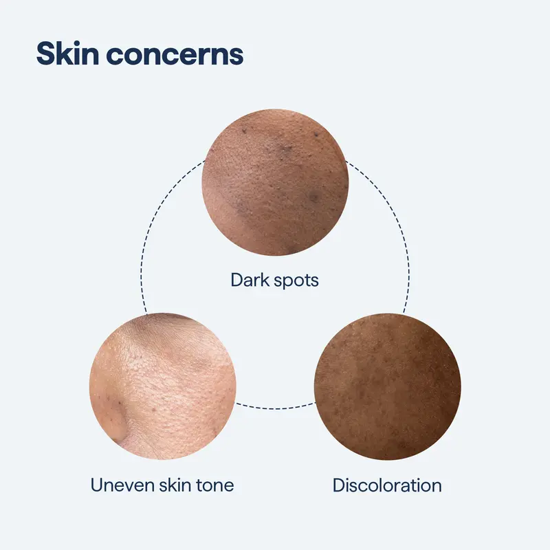 Anti-freckle essence