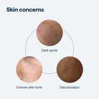 Anti-freckle essence